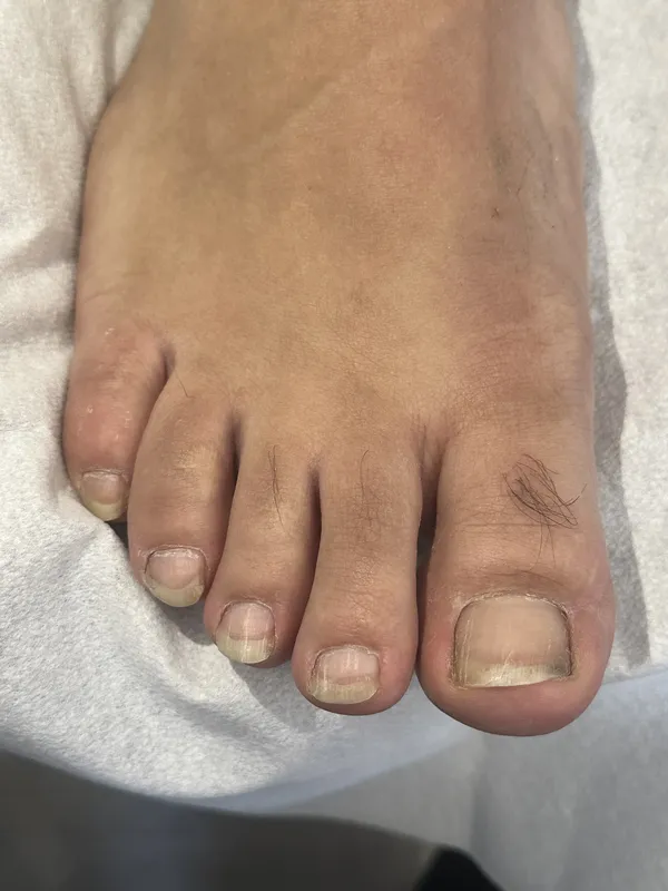 Antes e depois