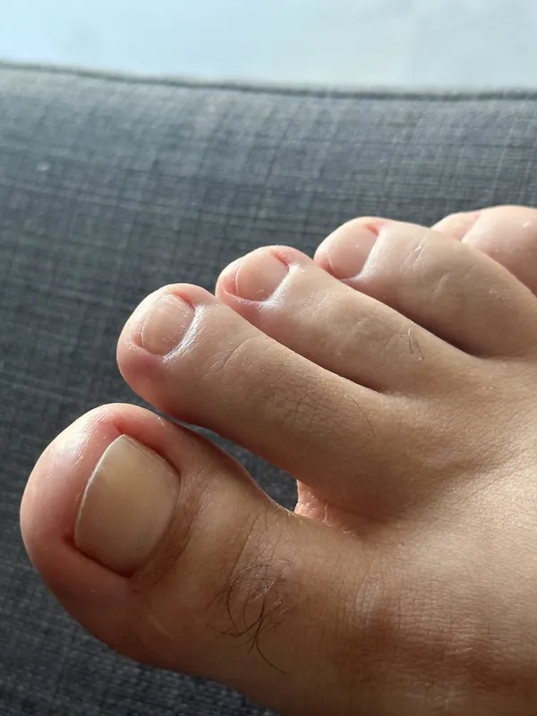 Antes e depois