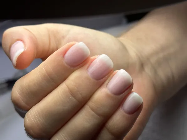 Antes e depois