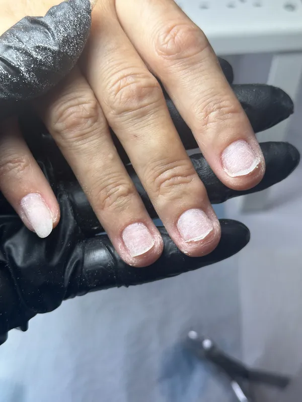 Antes e depois