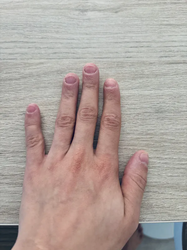 Antes e depois