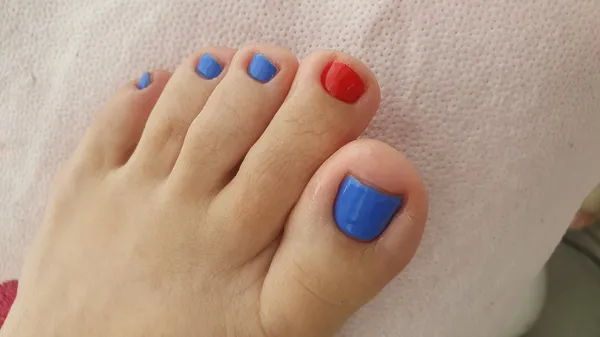 Pedicure