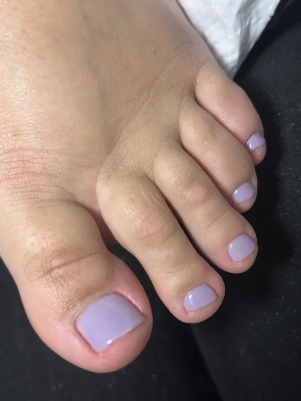 Pedicure